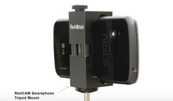 RetiCam smartphone mount