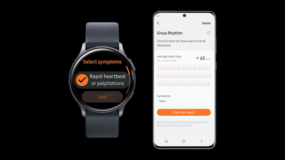 Samsung Galaxy Watch ECG Monitoring Feature SamMobile